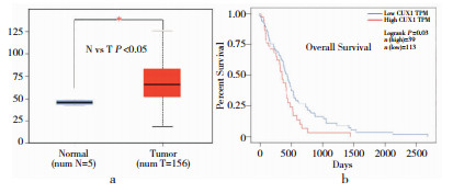 CUX-1在胶质瘤中的表达及其对临床病理和预后的意义