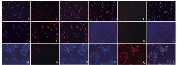HPK1过表达对乳腺癌MCF-7和MDA-MB-