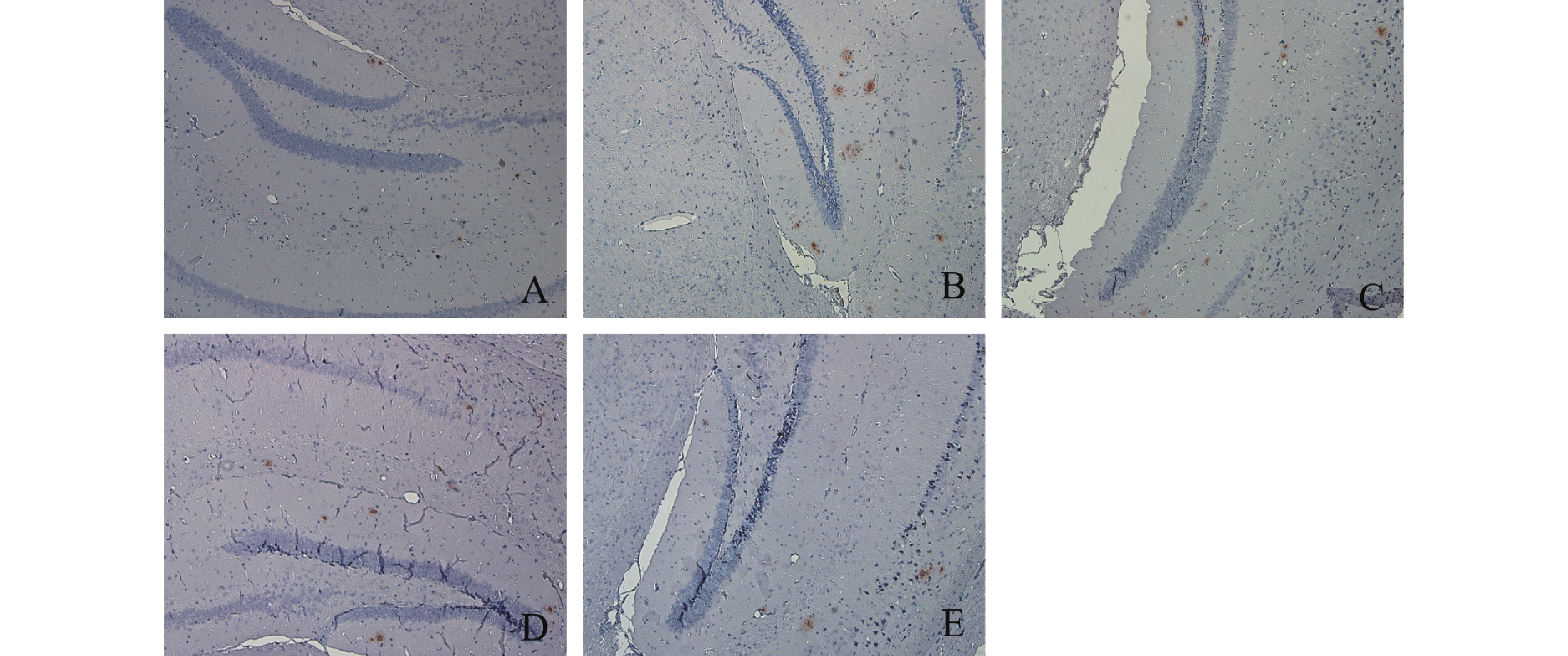 结果显示,小鼠脑海马和皮层处有不同程度的棕褐色细胞外沉淀物,该沉淀