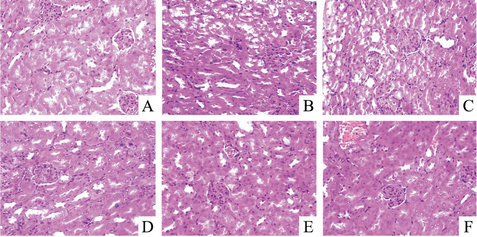 正常对照组肾脏的肾小球饱满,与囊壁无空隙,结构整齐 模型组小鼠肾