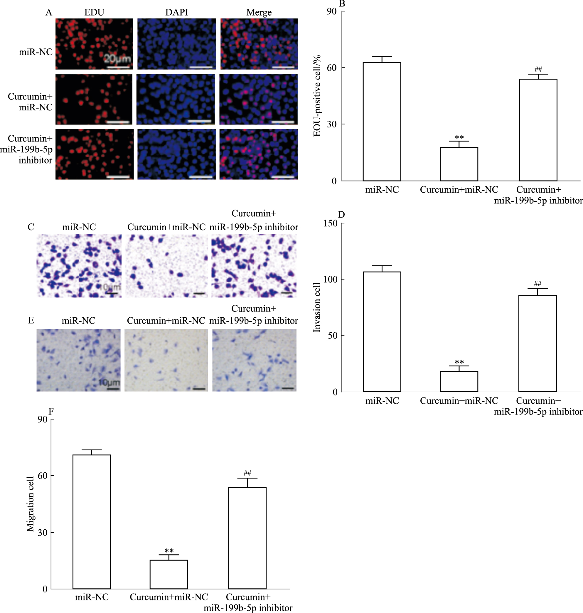 姜黄素通过miR-199b-5p抑制结肠癌SW1116细胞的增殖、迁移和侵袭