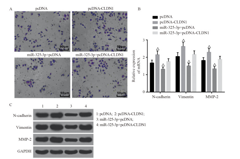 miR-325-3p靶向CLDN1基因调控胃癌上皮间质转化和侵袭转移
