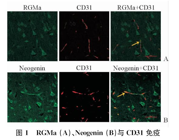 图 1 rgma (a),neogenin (b)与cd31免疫荧光双标阳性细胞染色  fig 1