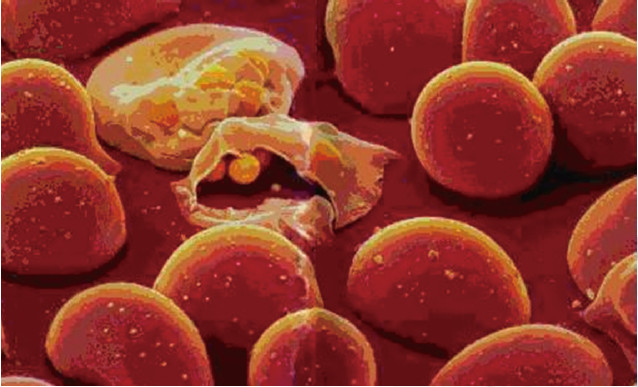 疟原虫侵入红细胞,使红细胞破裂
