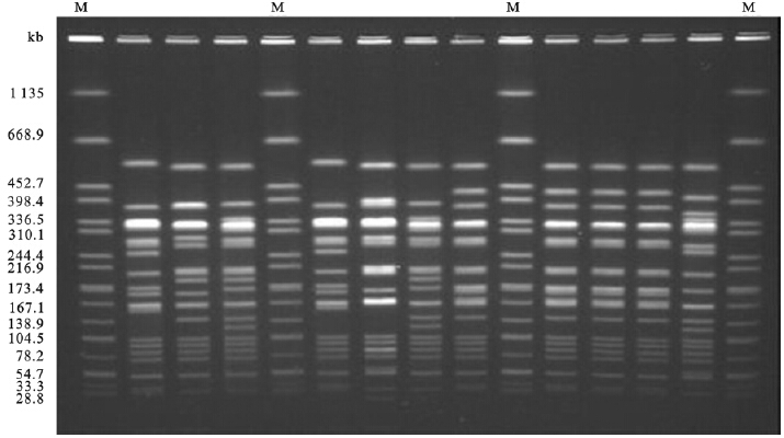 部分伤寒沙门菌株pfge电泳图谱