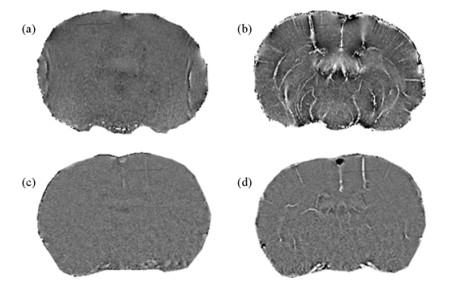 Uspio USPIO High Resolution Neurovascular Imaging in a Rat Stroke Model of ...