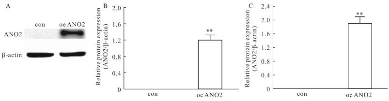 邻苯二甲酸二异丁酯——新型的ANO2通道开放剂