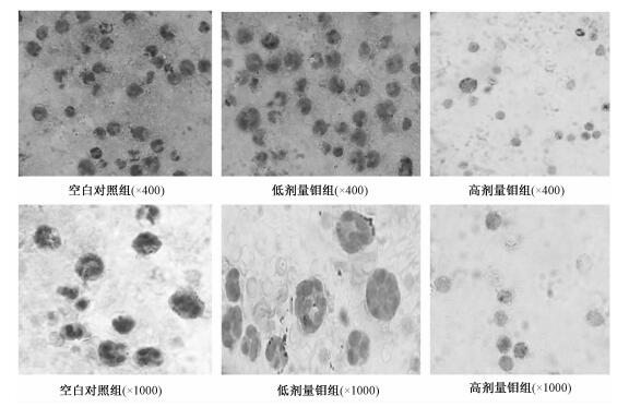 鉬對小白鼠免疫功能的影響研究