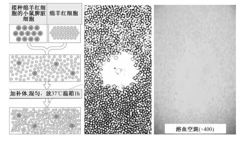 溶血空斑形成示意图