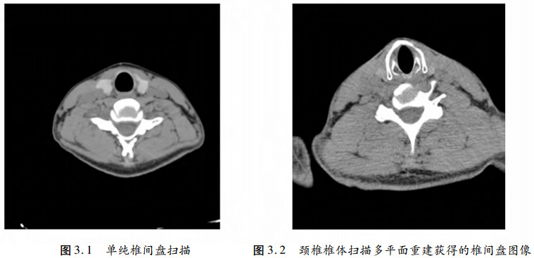 锥形束CT和螺旋CT图片