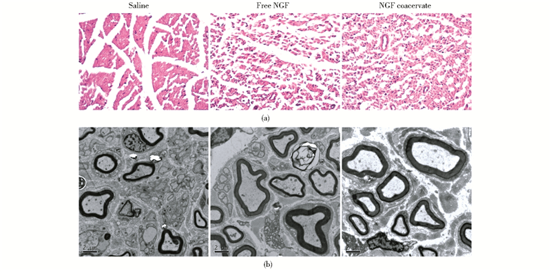 pead肝素ngf生物材料促进大鼠坐骨神经损伤恢复